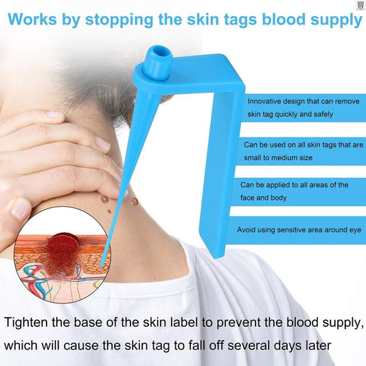 SKIN TAG REMOVER KIT