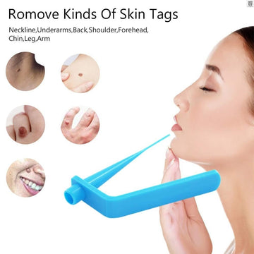 SKIN TAG REMOVER KIT